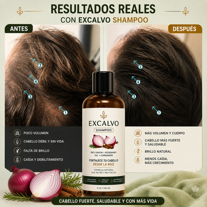 Frena la Caída y recupera tu cabello con Excalvo.